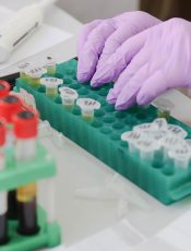 Dlaczego prawidłowy poziom czerwonych krwinek jest tak ważny?