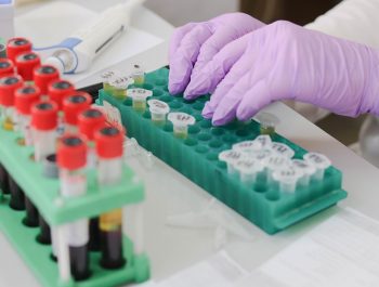 Dlaczego prawidłowy poziom czerwonych krwinek jest tak ważny?